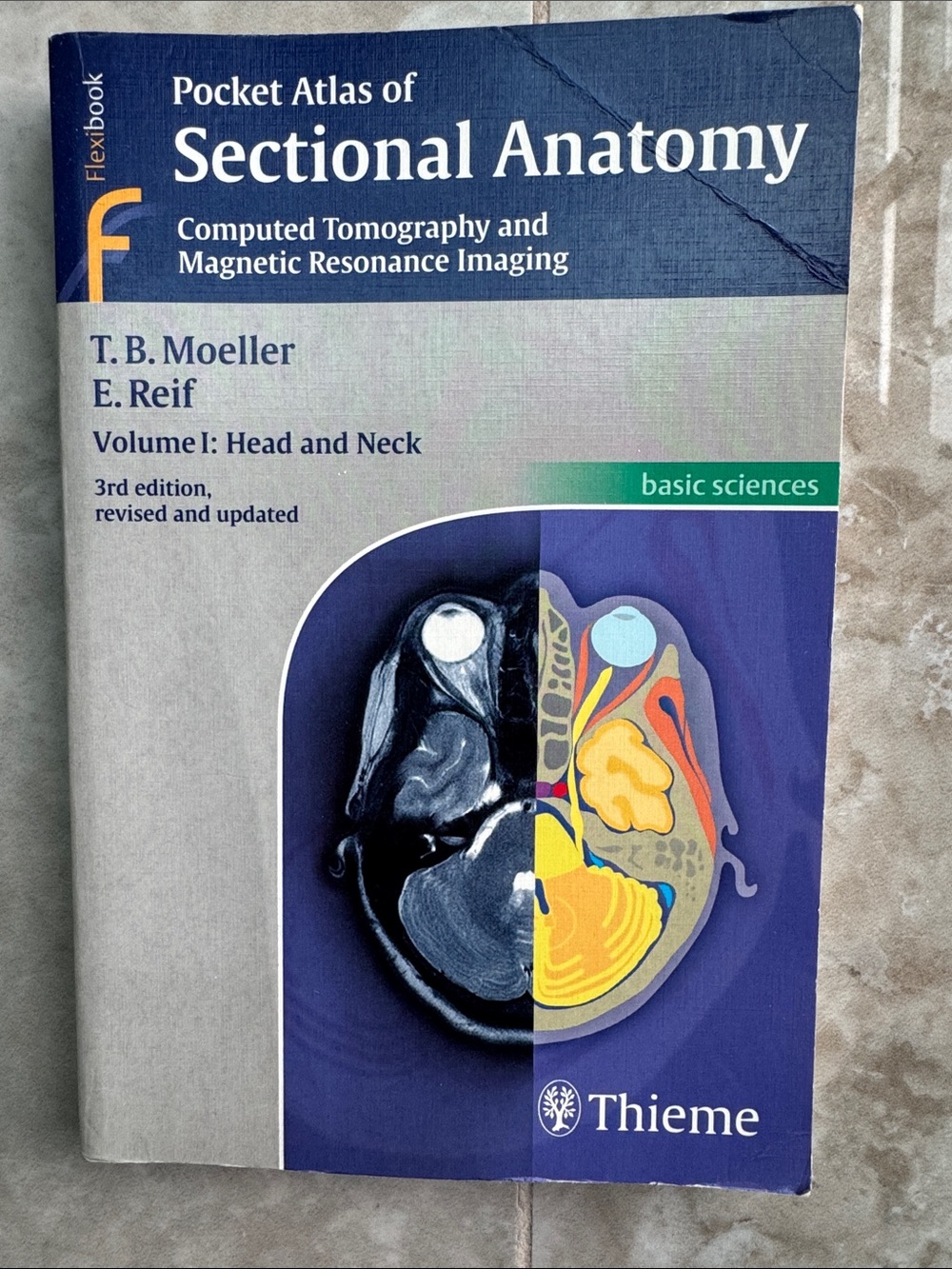 Pocket Atlas of Sectional Anatomy Volume 1: Head & Neck 3rd Ed by Moeller & Reif